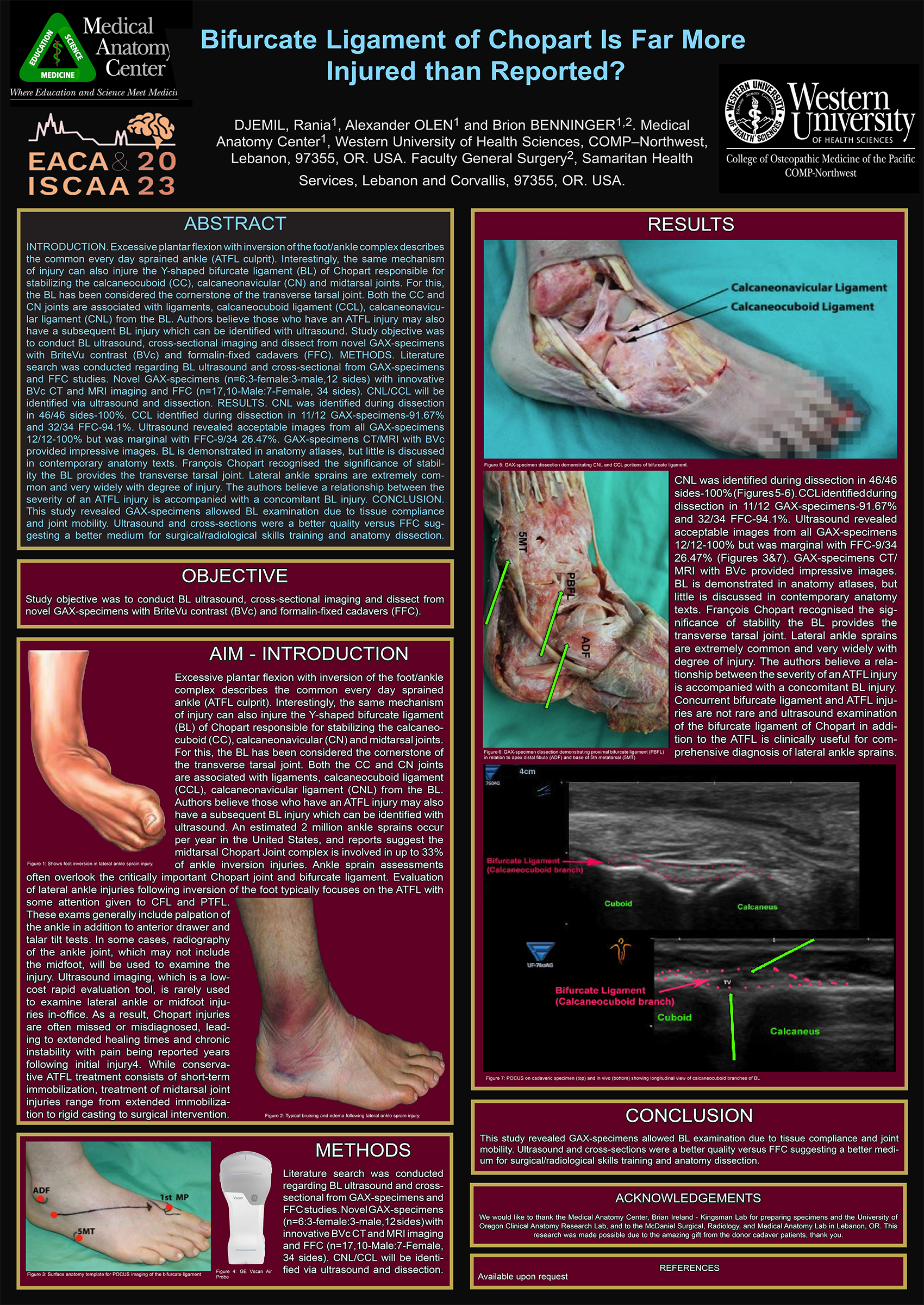Bifurcate ligament of Chopart research poster (2023)