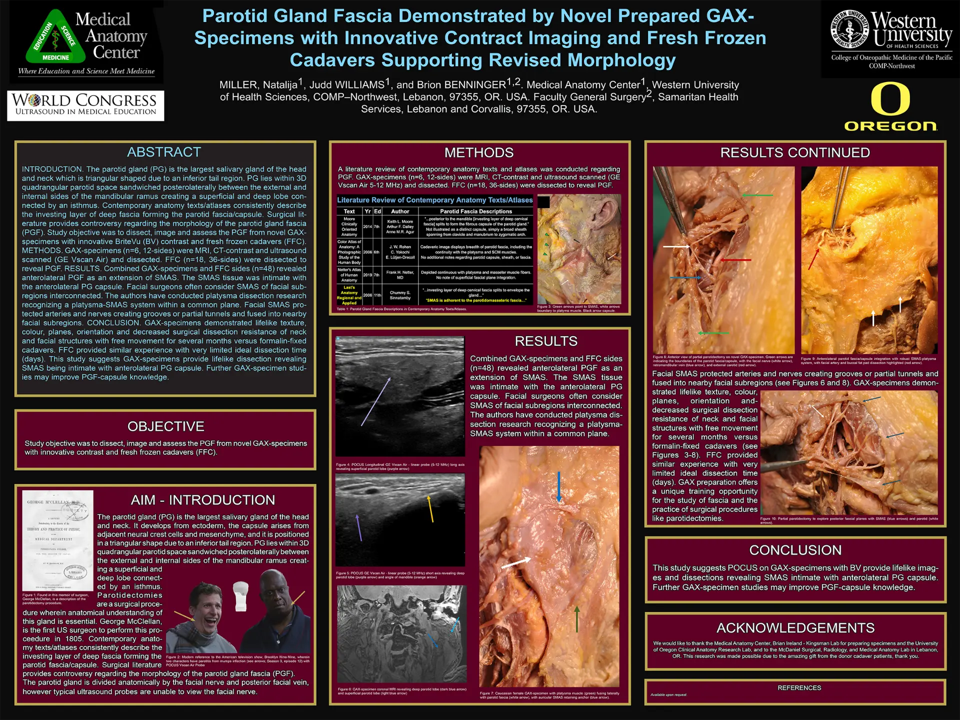 Parotid gland fascia research poster (2023)