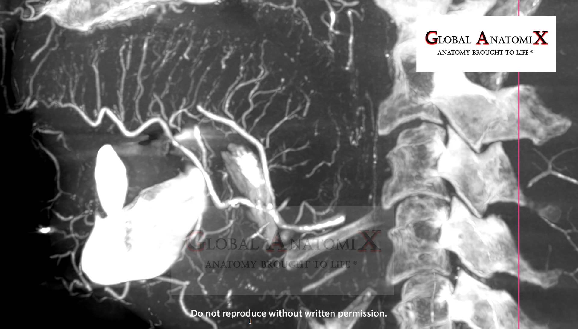 Tongue vasculature