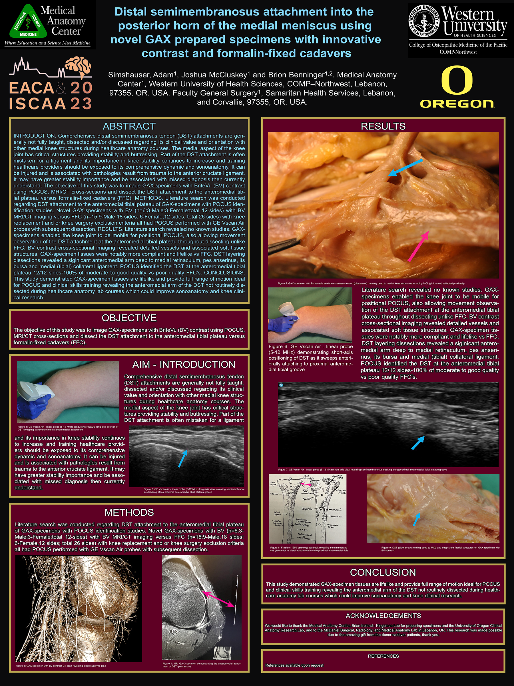 Semimembranosus attachment research poster (2023)