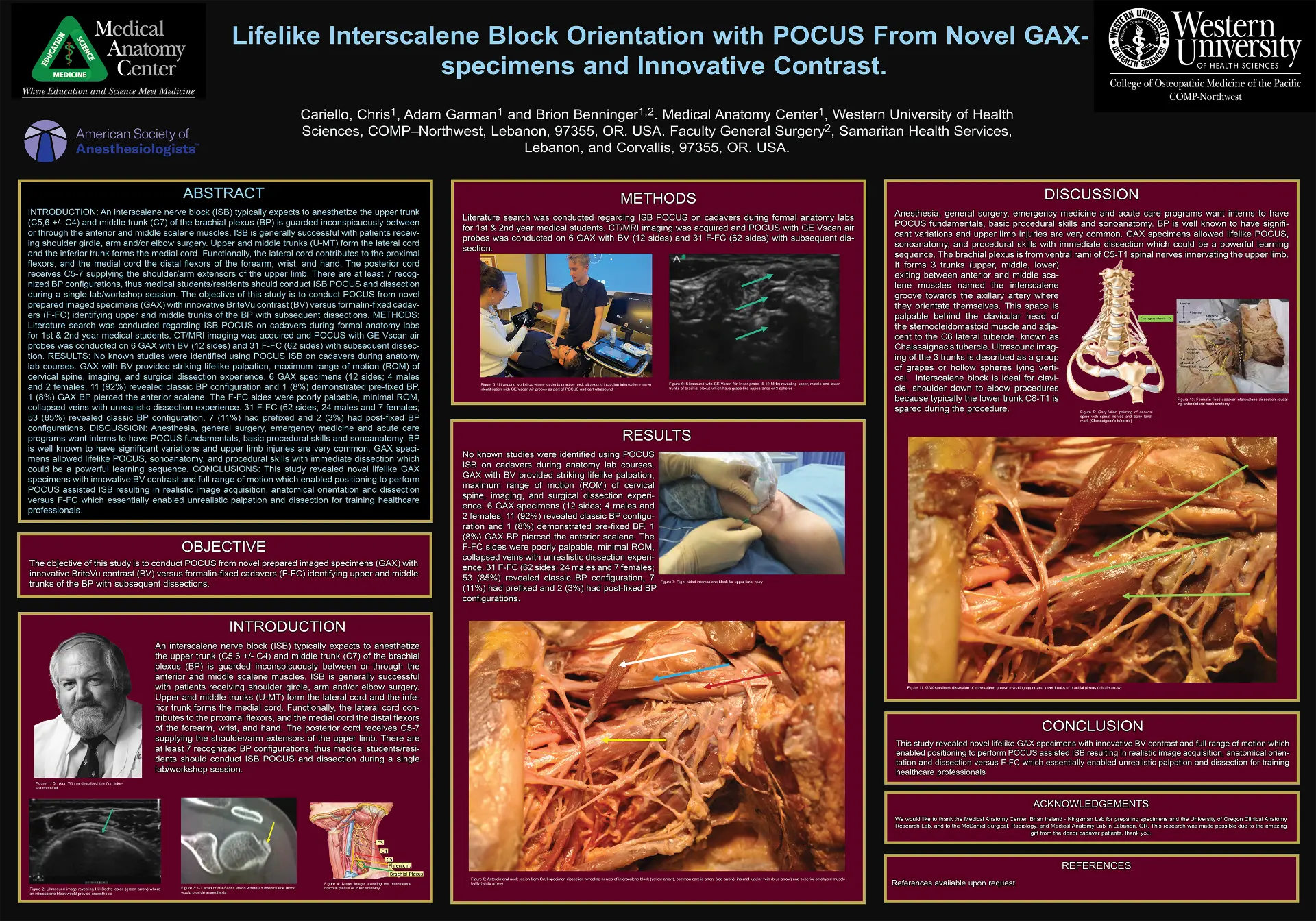 Interscalene block research poster (2023)
