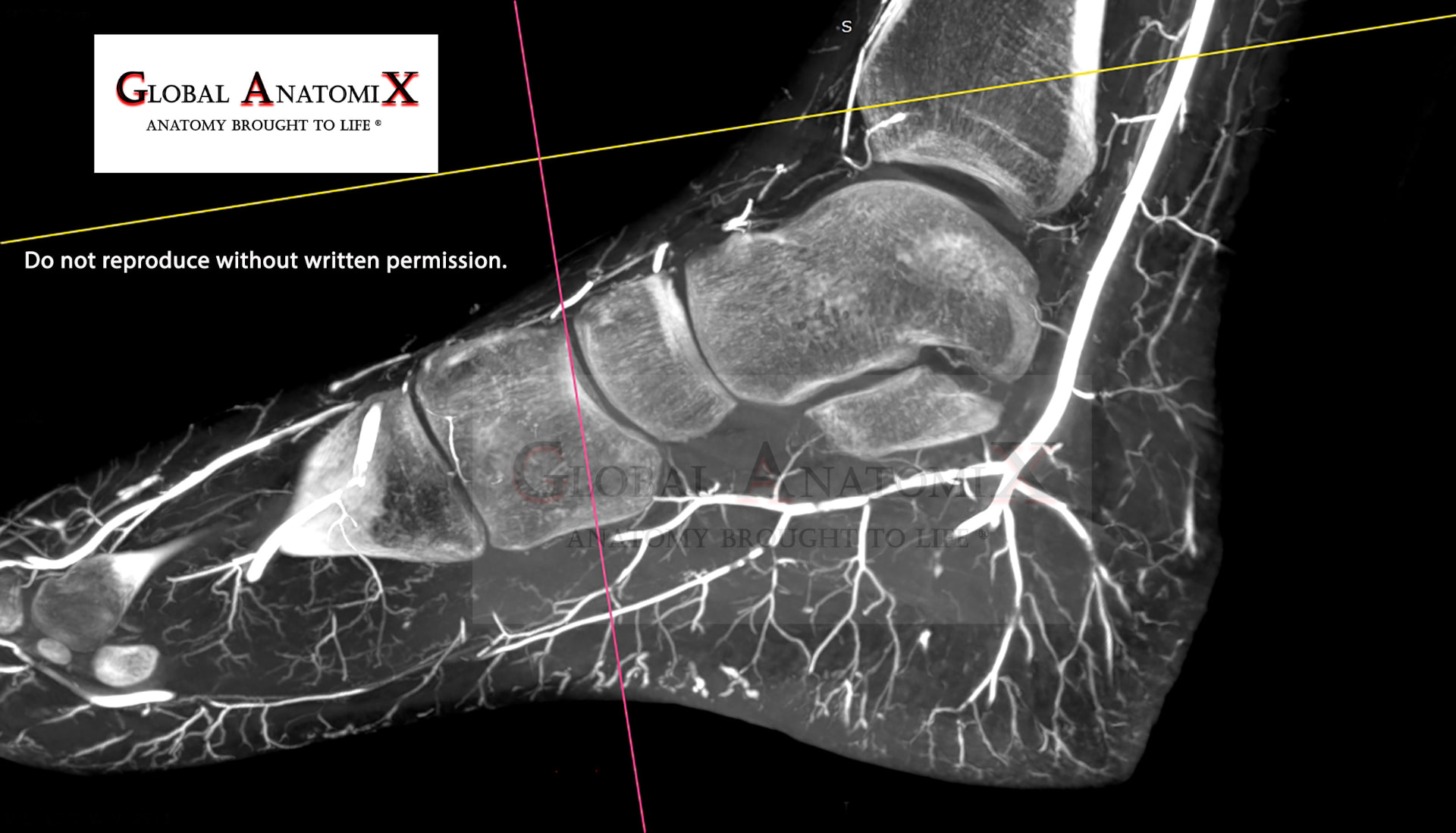 Foot, sagittal view