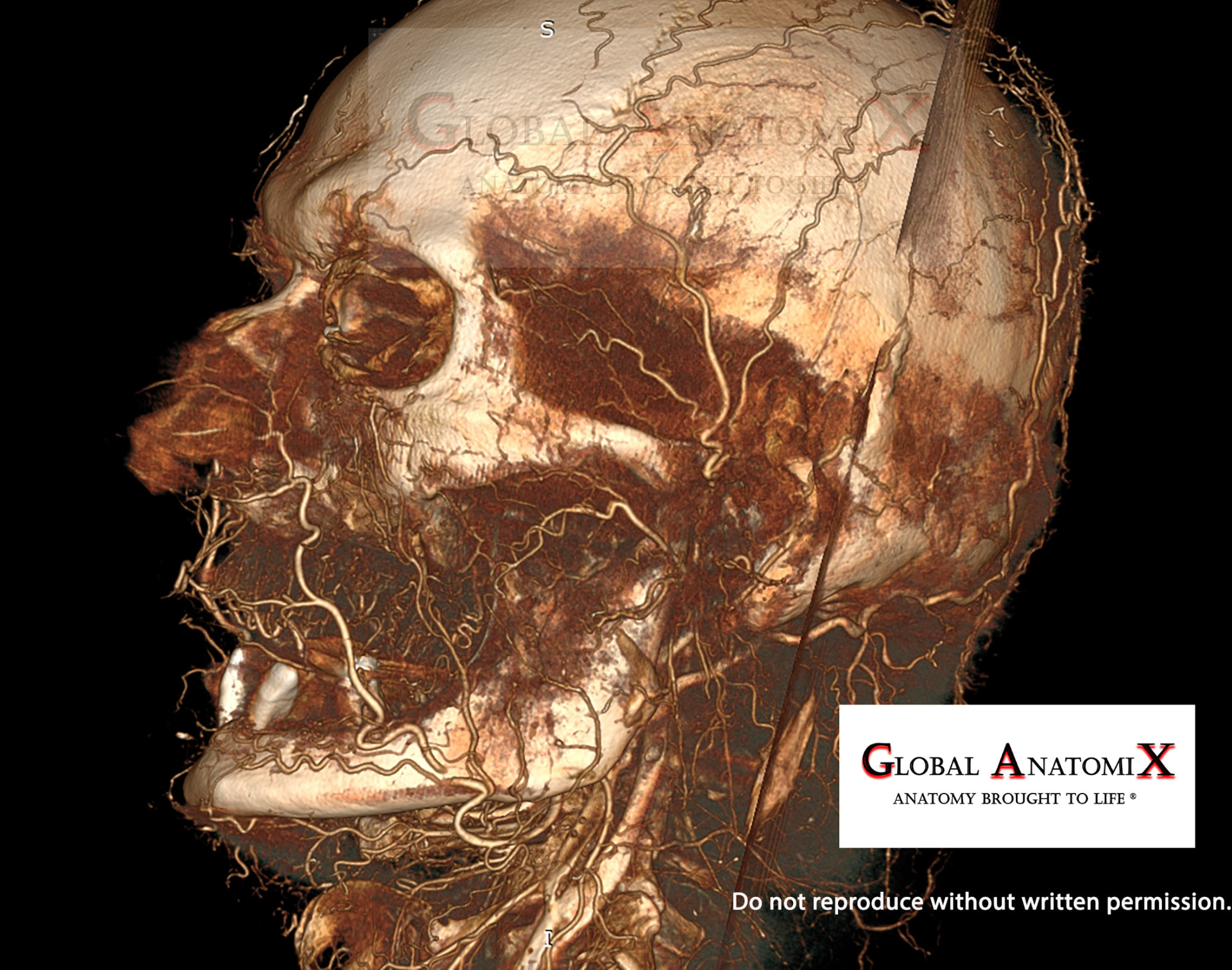 Lateral facial vasculature