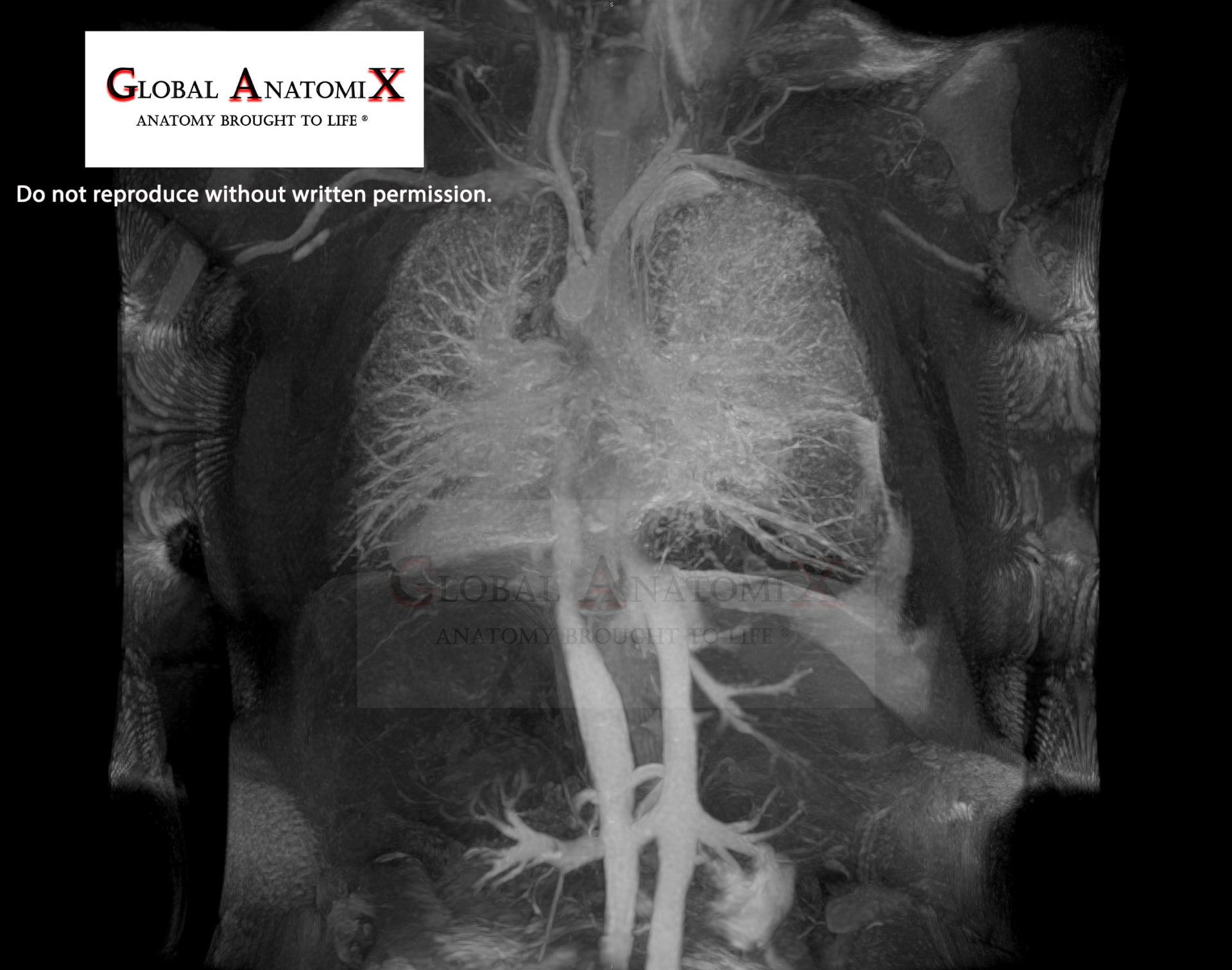 Chest and abdomen with gadolinium