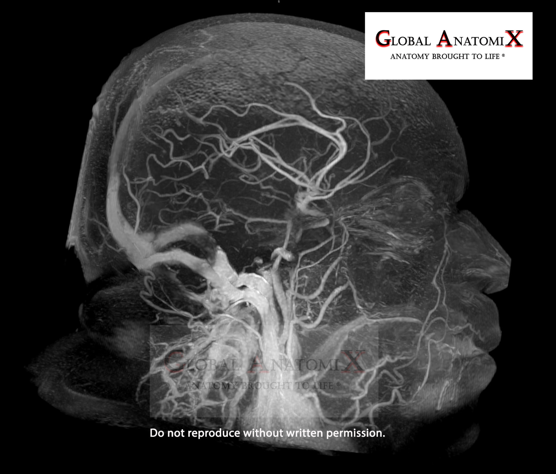 Head and brain with gadolinium, MIP