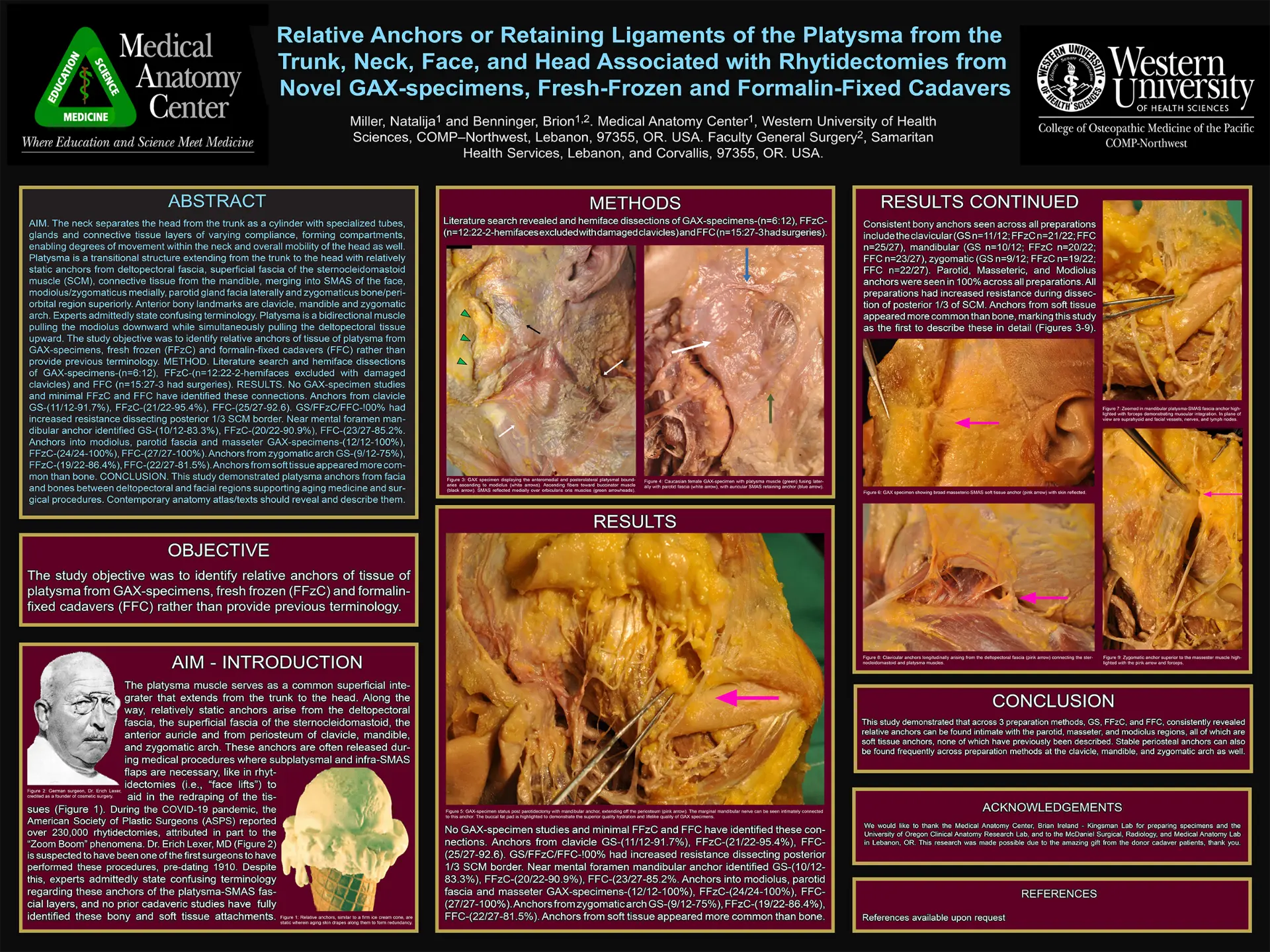 Retaining ligament of platysma research poster (2023)