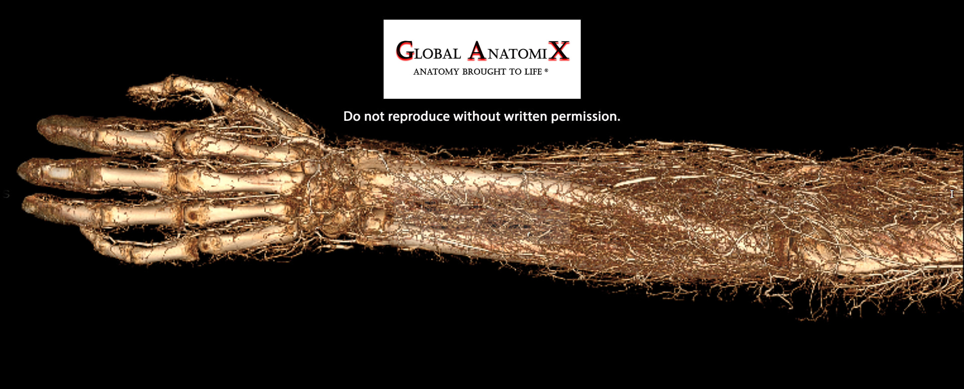 Forearm, dorsal 3D view