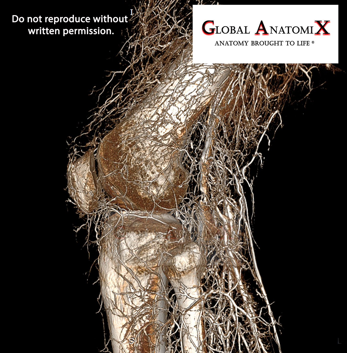 Mid leg, lateral 3D view