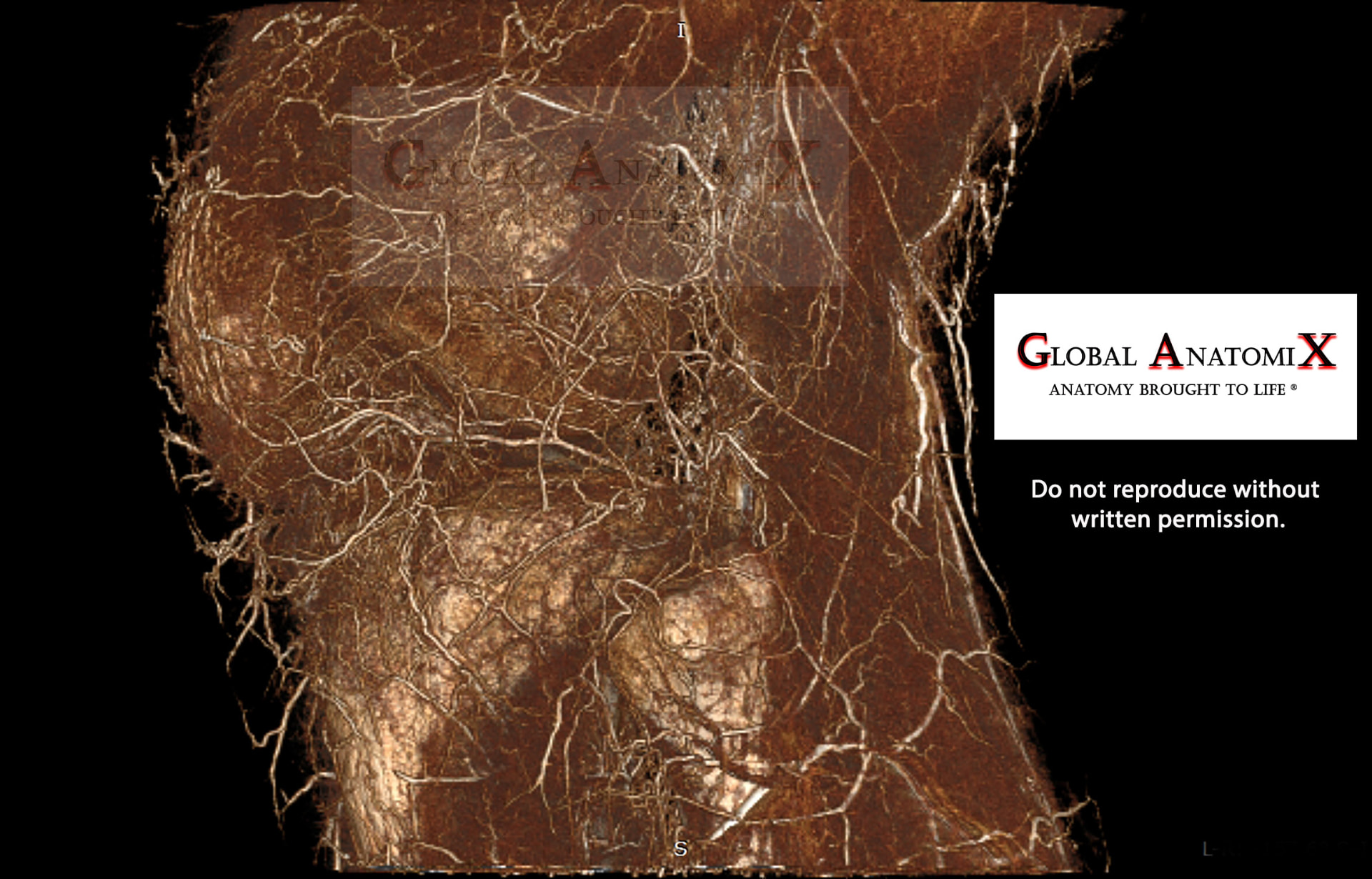 Lateral knee superficial vasculature, 3D