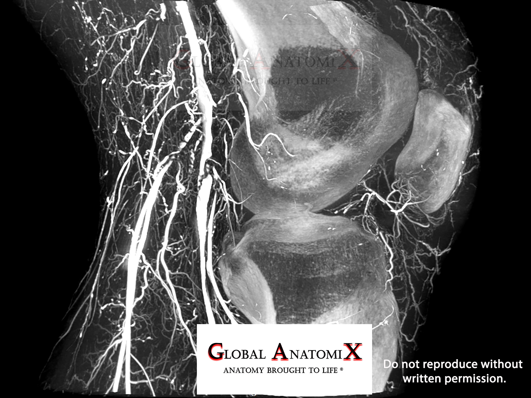 Stifle, sagittal view