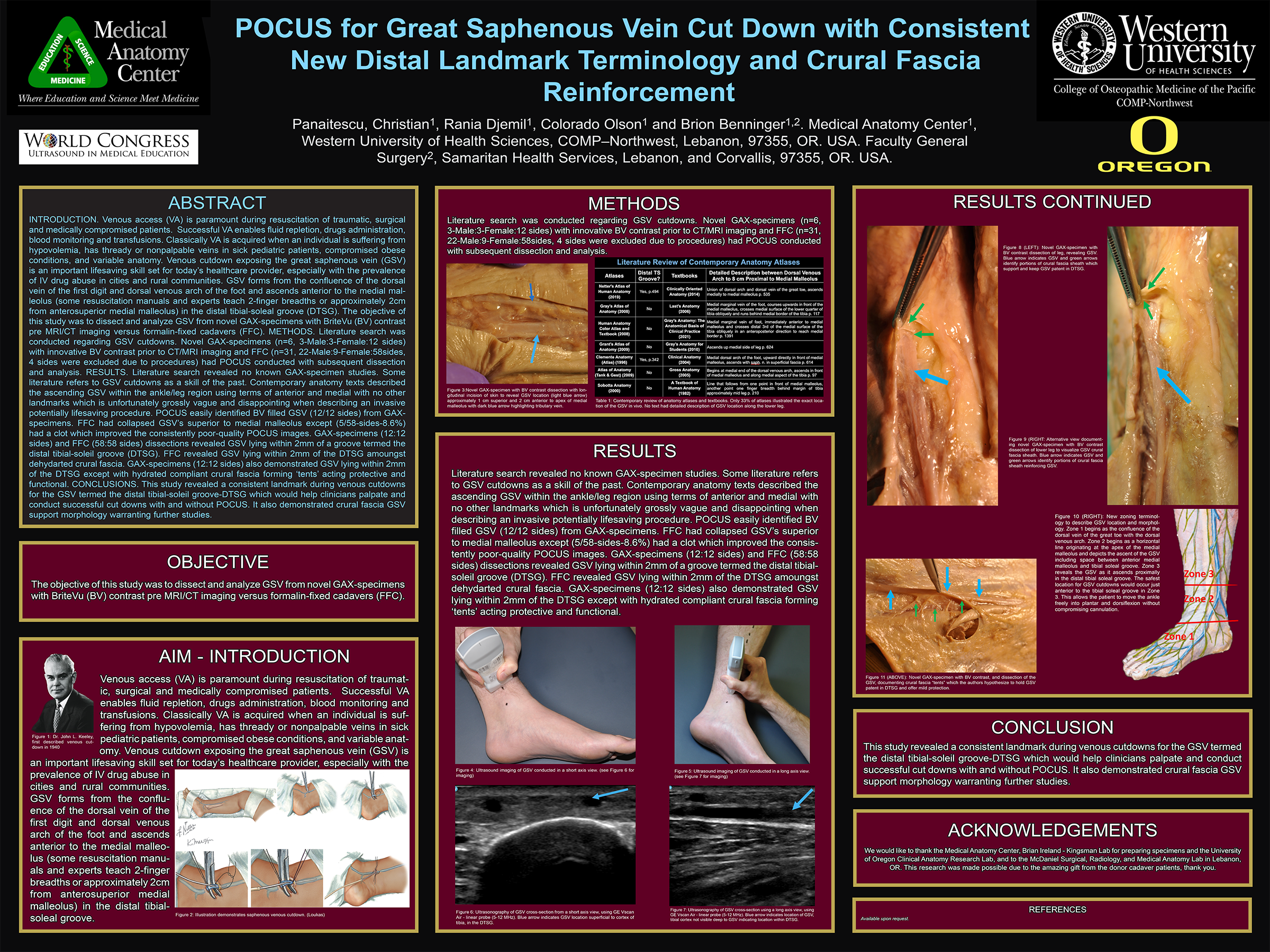 Saphenous cut down research poster (2023)