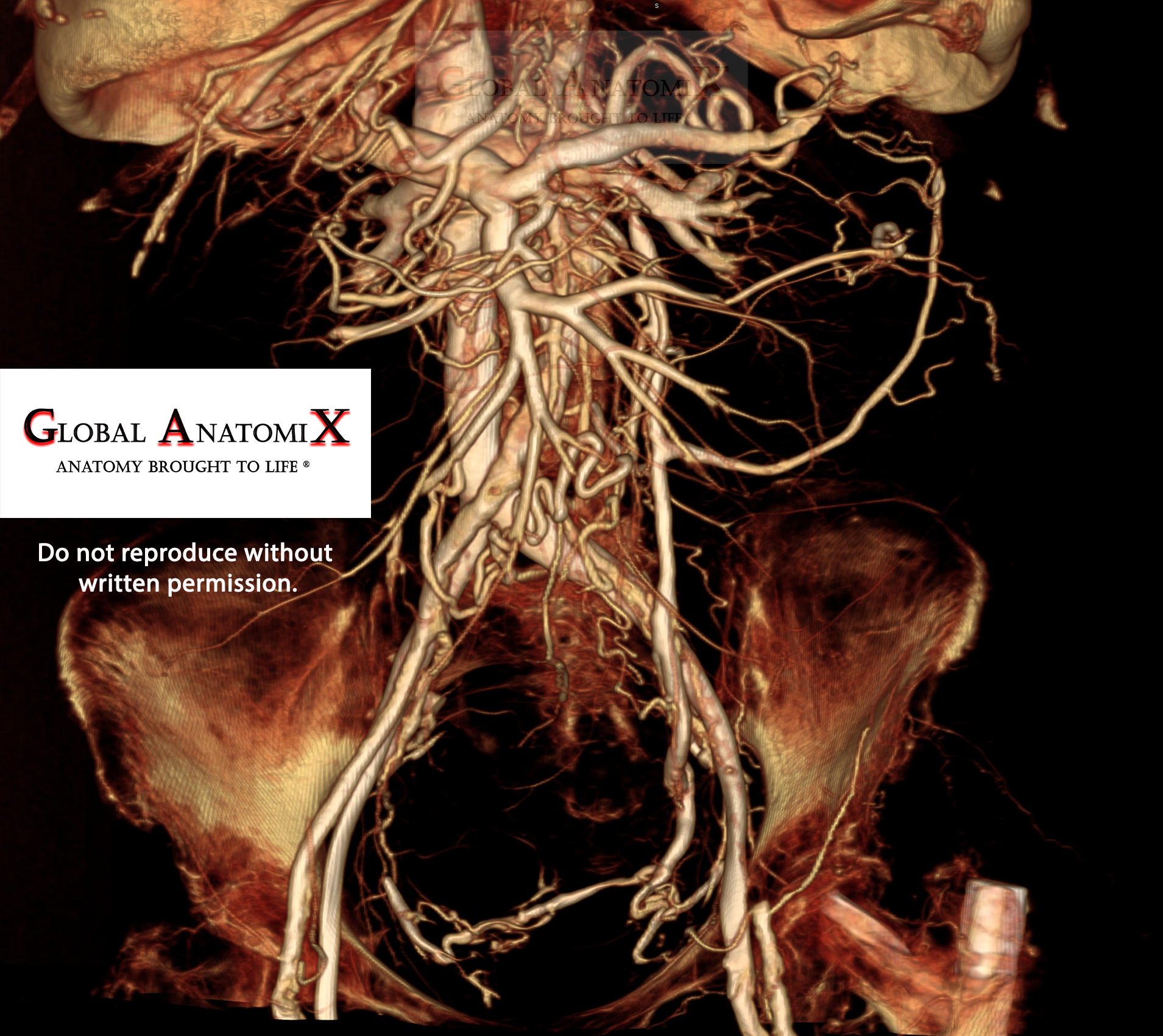 Abdominal vasculature with BriteVu®, view 2