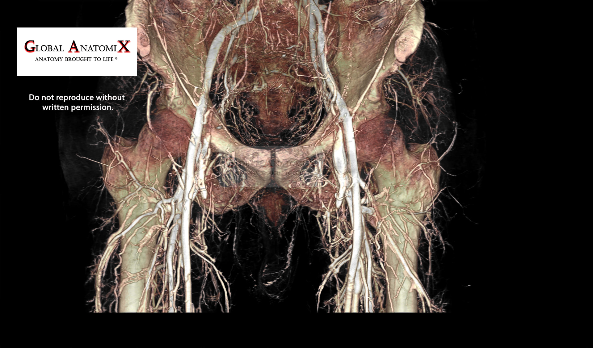 Pelvis and upper thigh vasculature, view 2