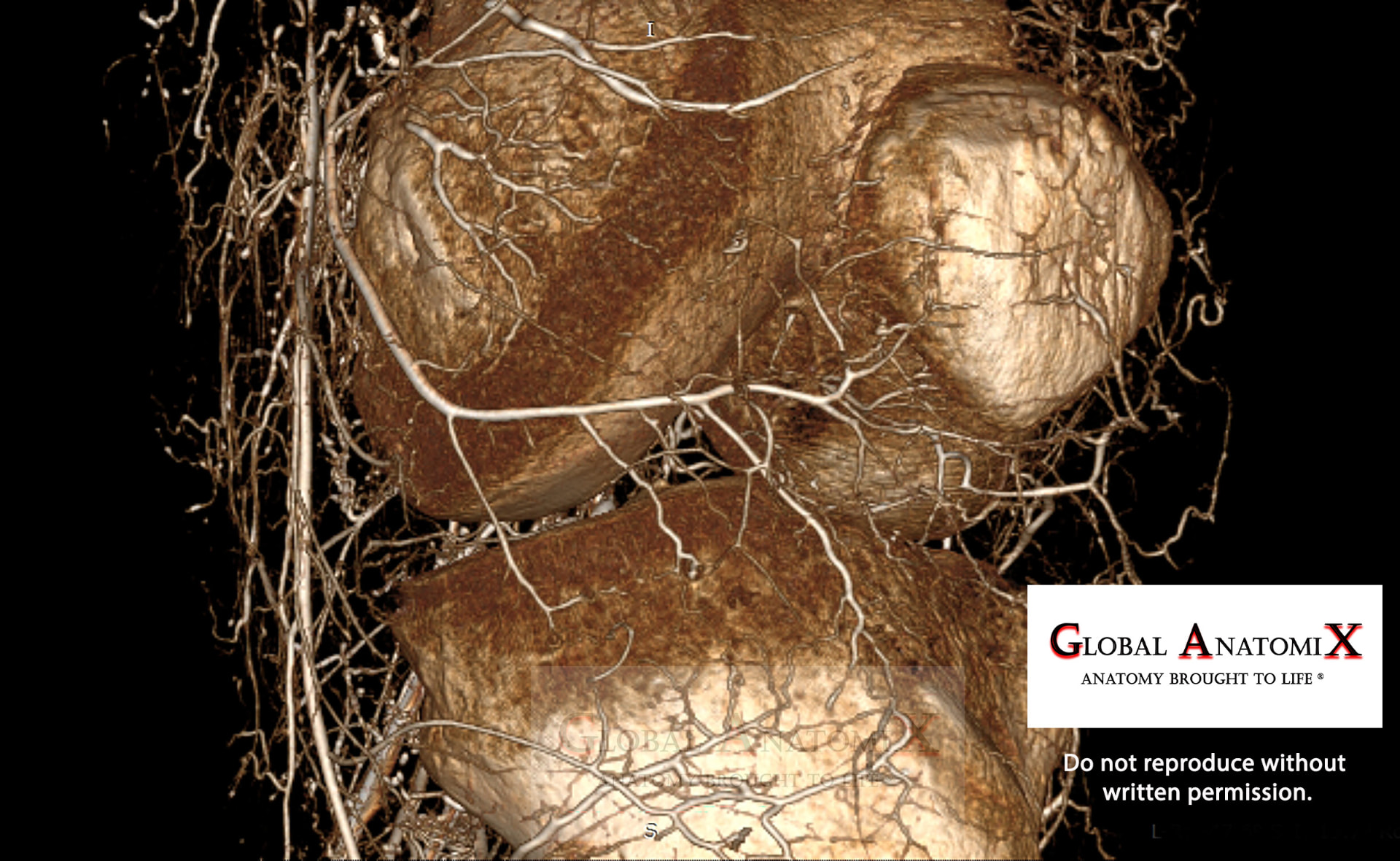 Cranial stifle vasculature, 3D