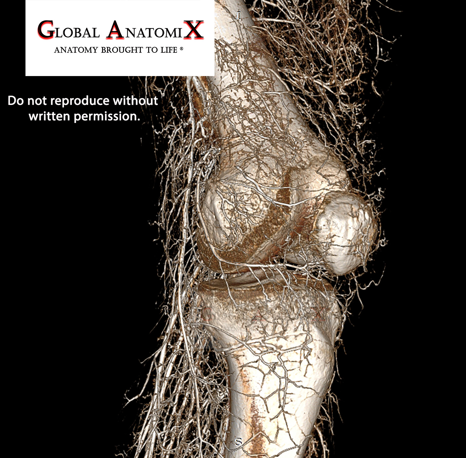 Stifle, anterior oblique 3D view
