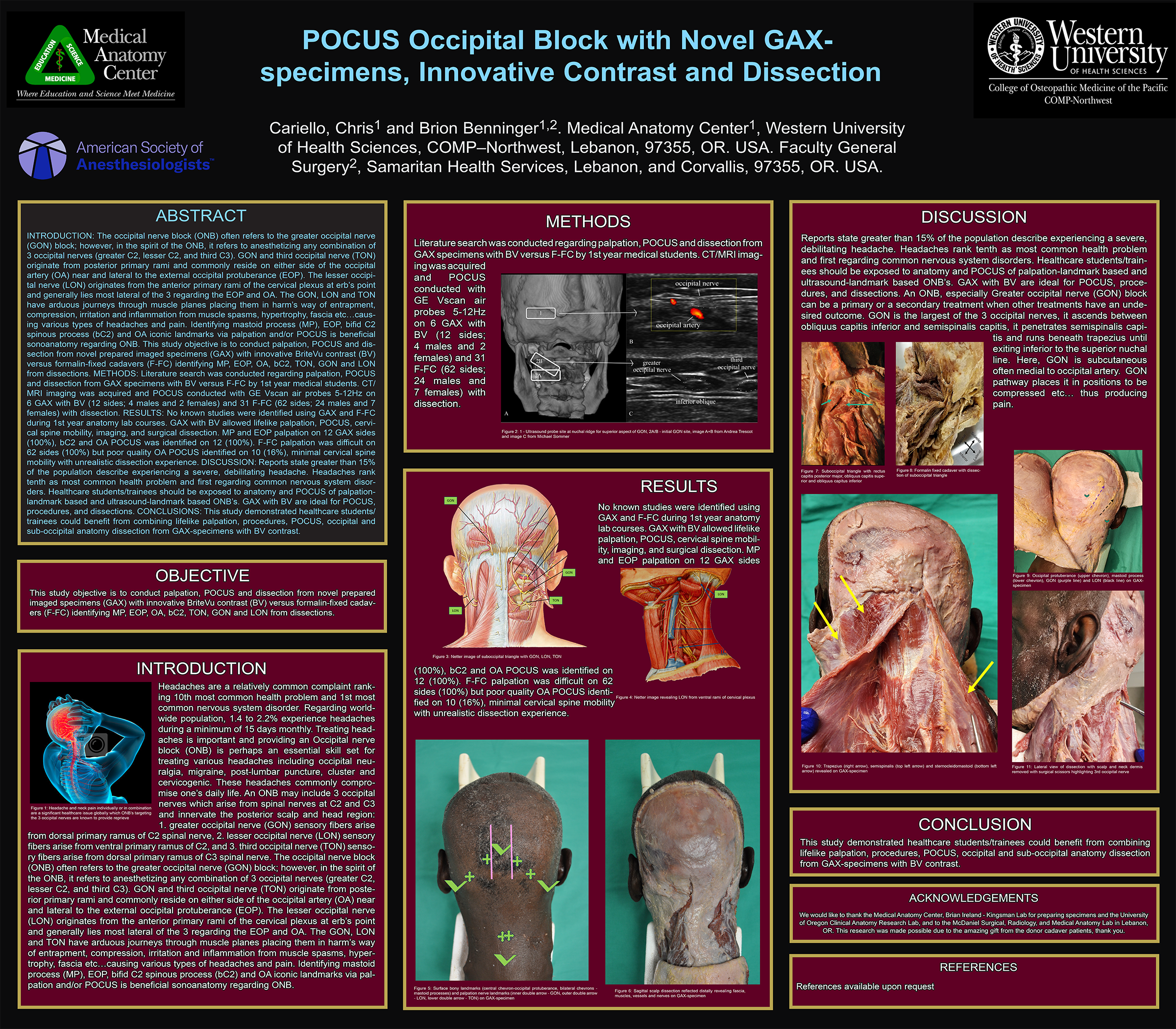 Occipital block research poster (2023)