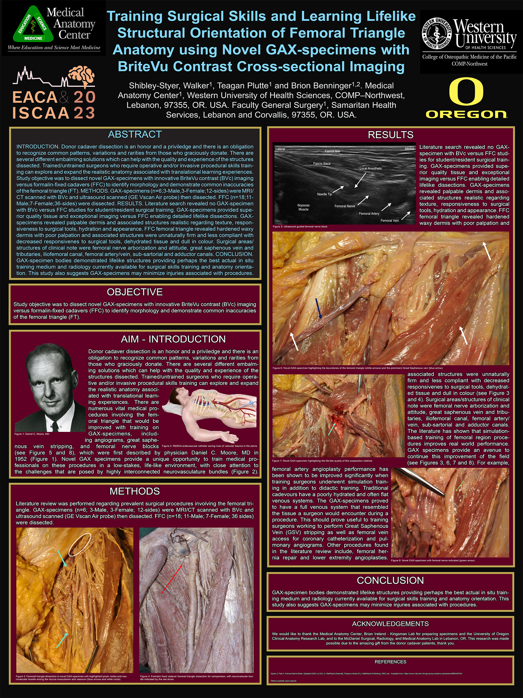 Femoral triangle anatomy research poster (2023)