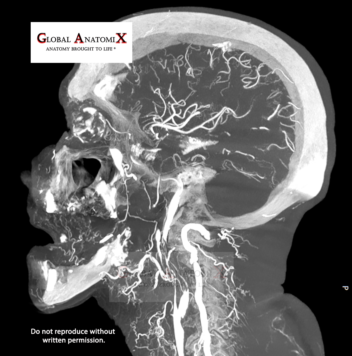 Brain, sagittal view