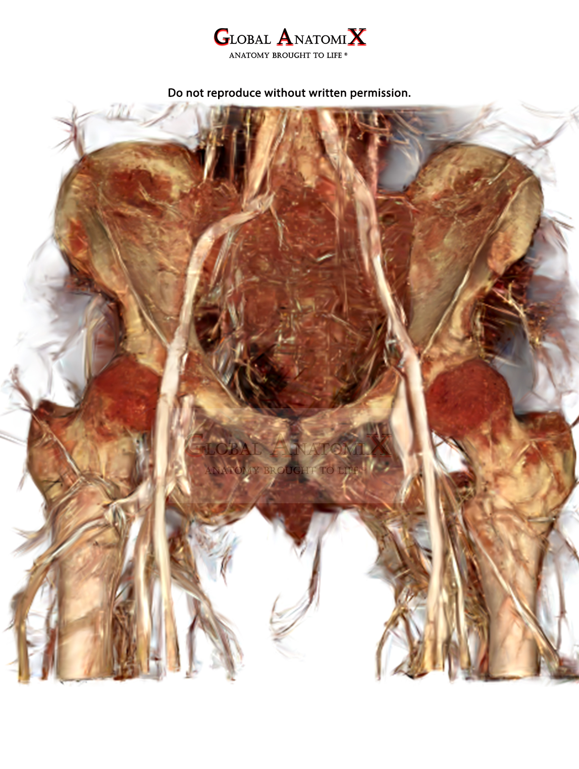 Pelvis and upper thigh vasculature