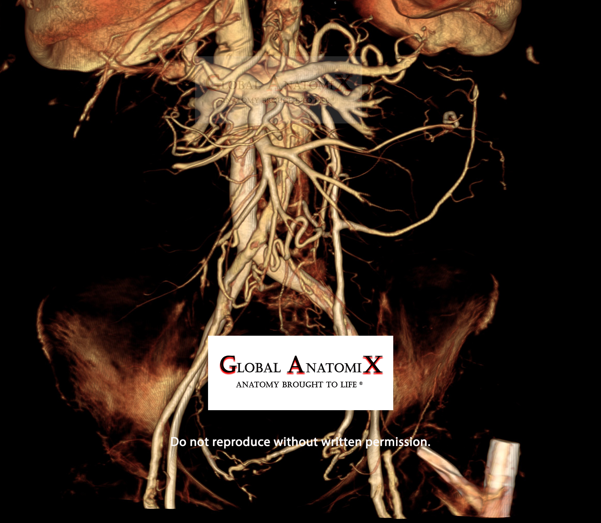 Abdominal vasculature with BriteVu®