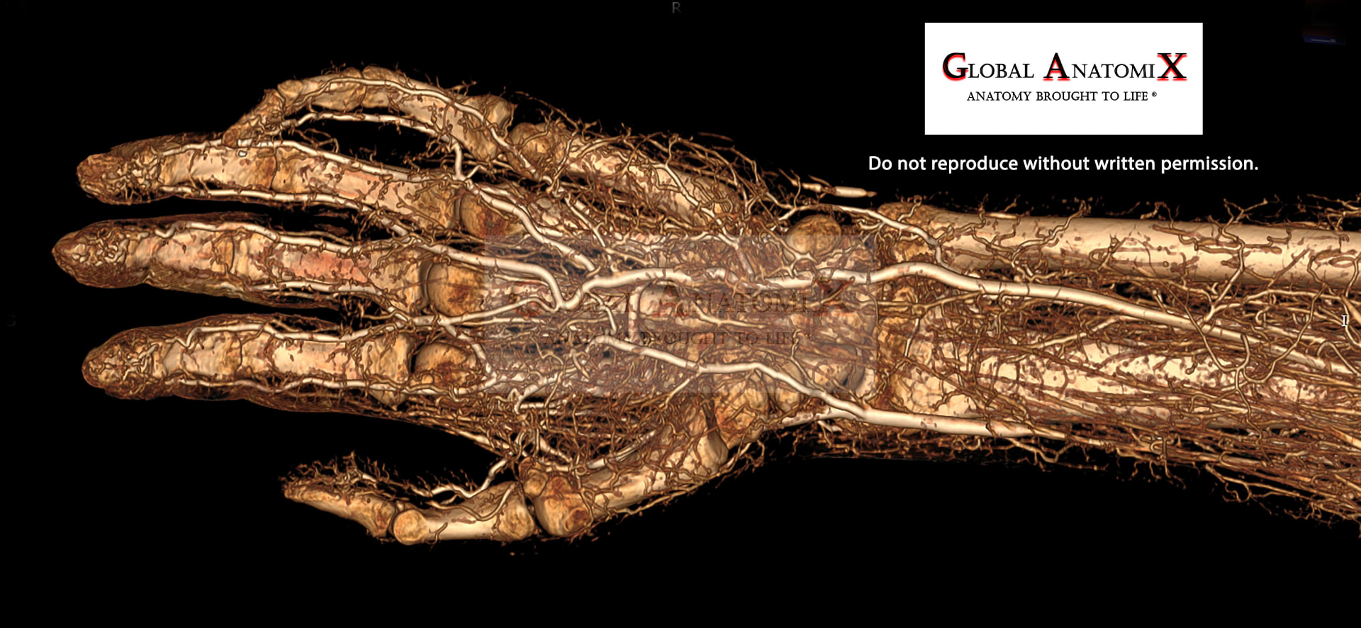Distal arm and hand, palmar view