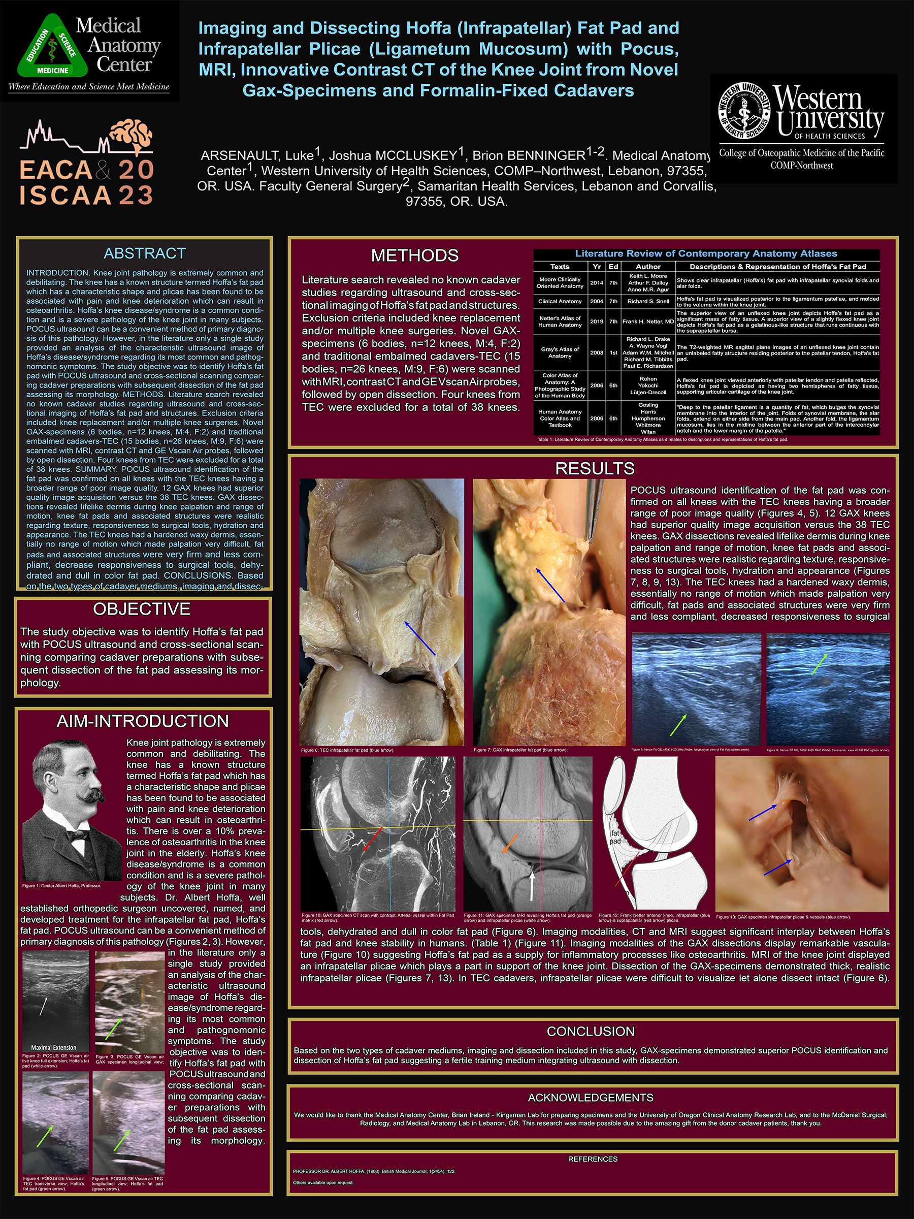 Hoffa fat pad research poster (2023)