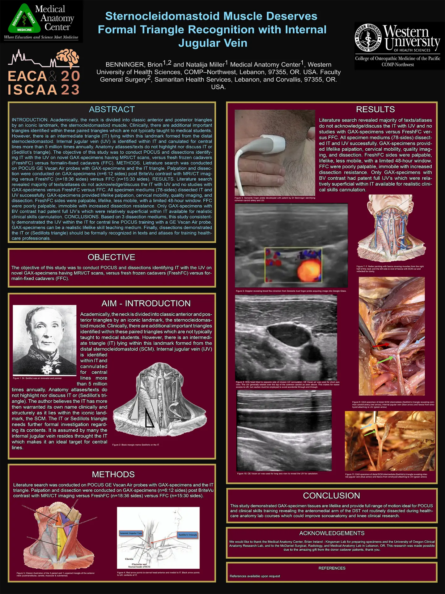 Sternocleidomastoid muscle research poster (2023)