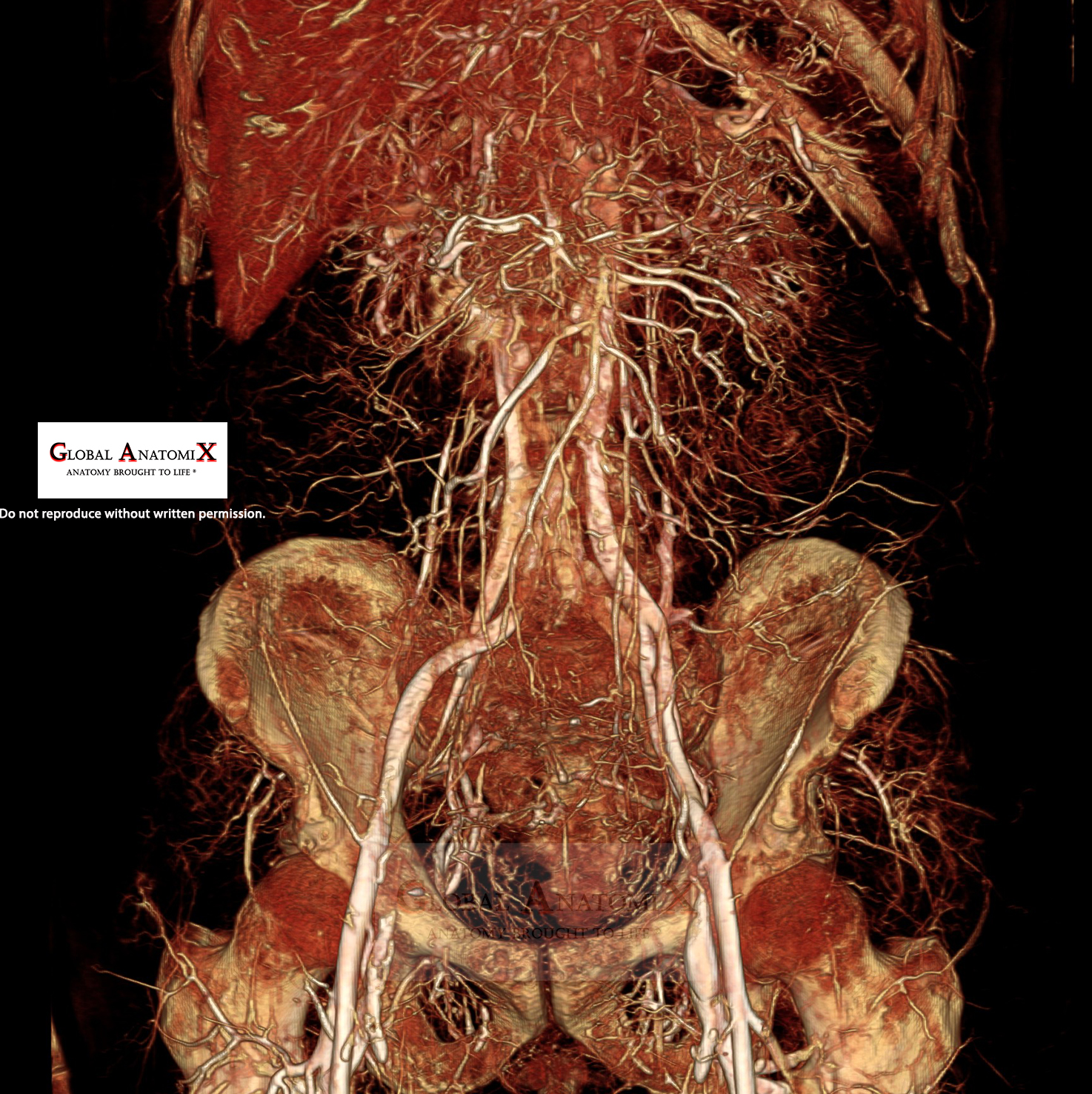 Abdominal vasculature with BriteVu®, view 3