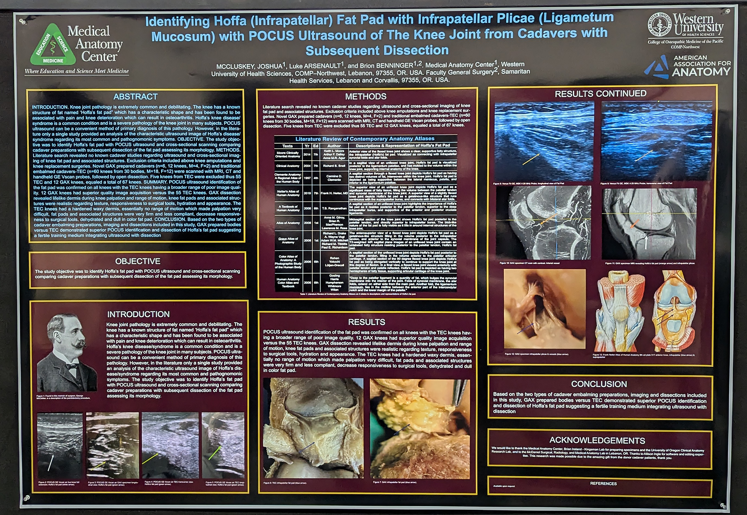GAX and human knee research poster (2025)