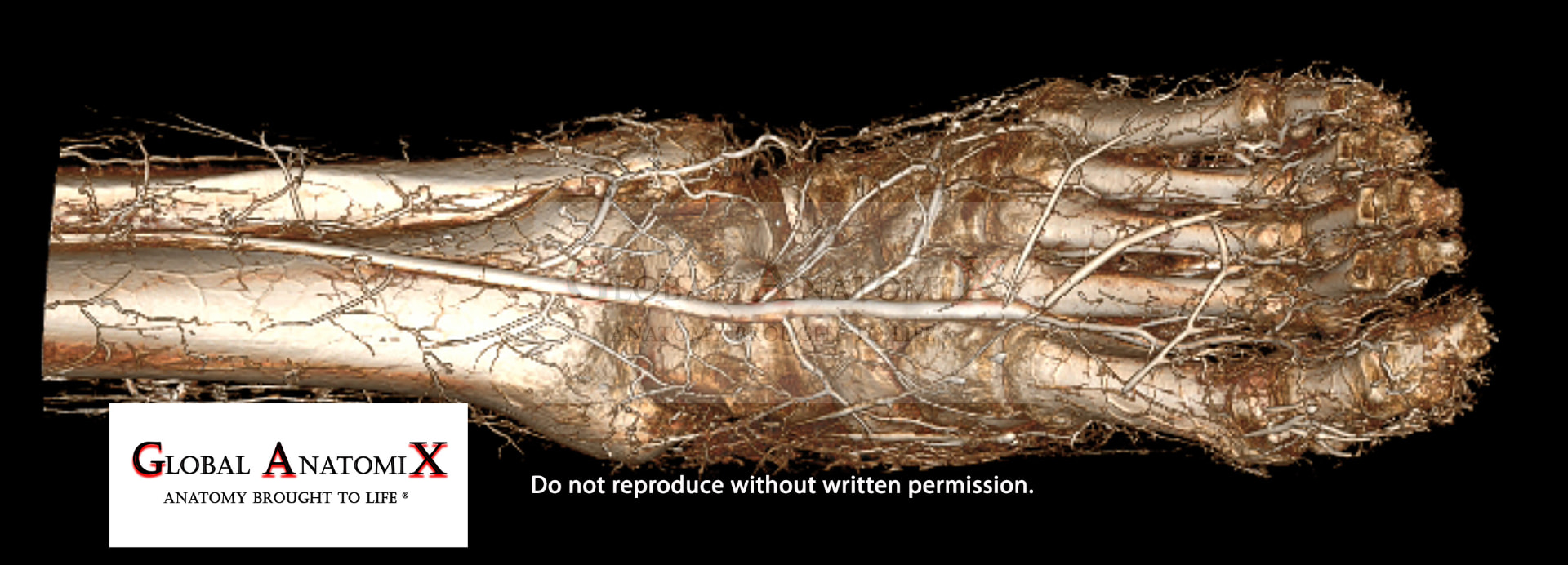 Foot, dorsal 3D view