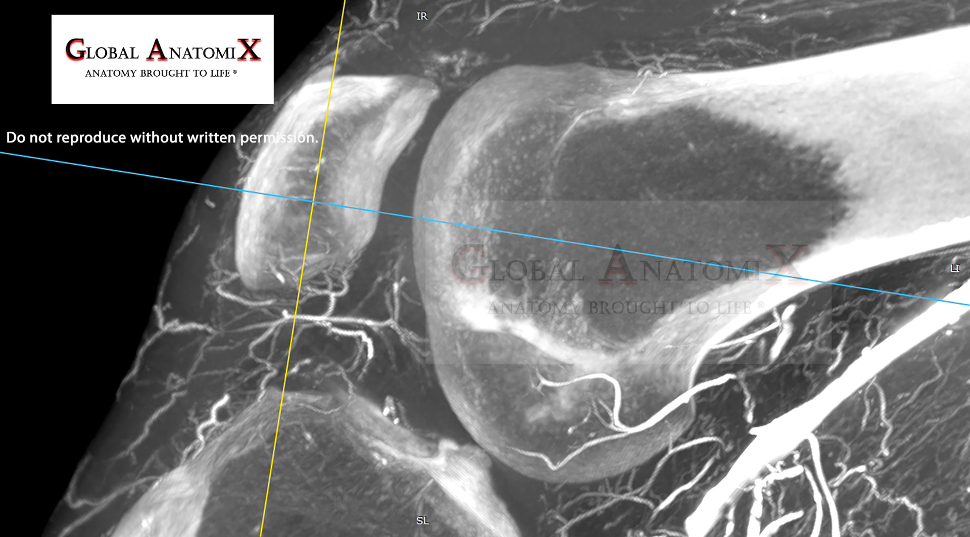 Knee, sagittal view