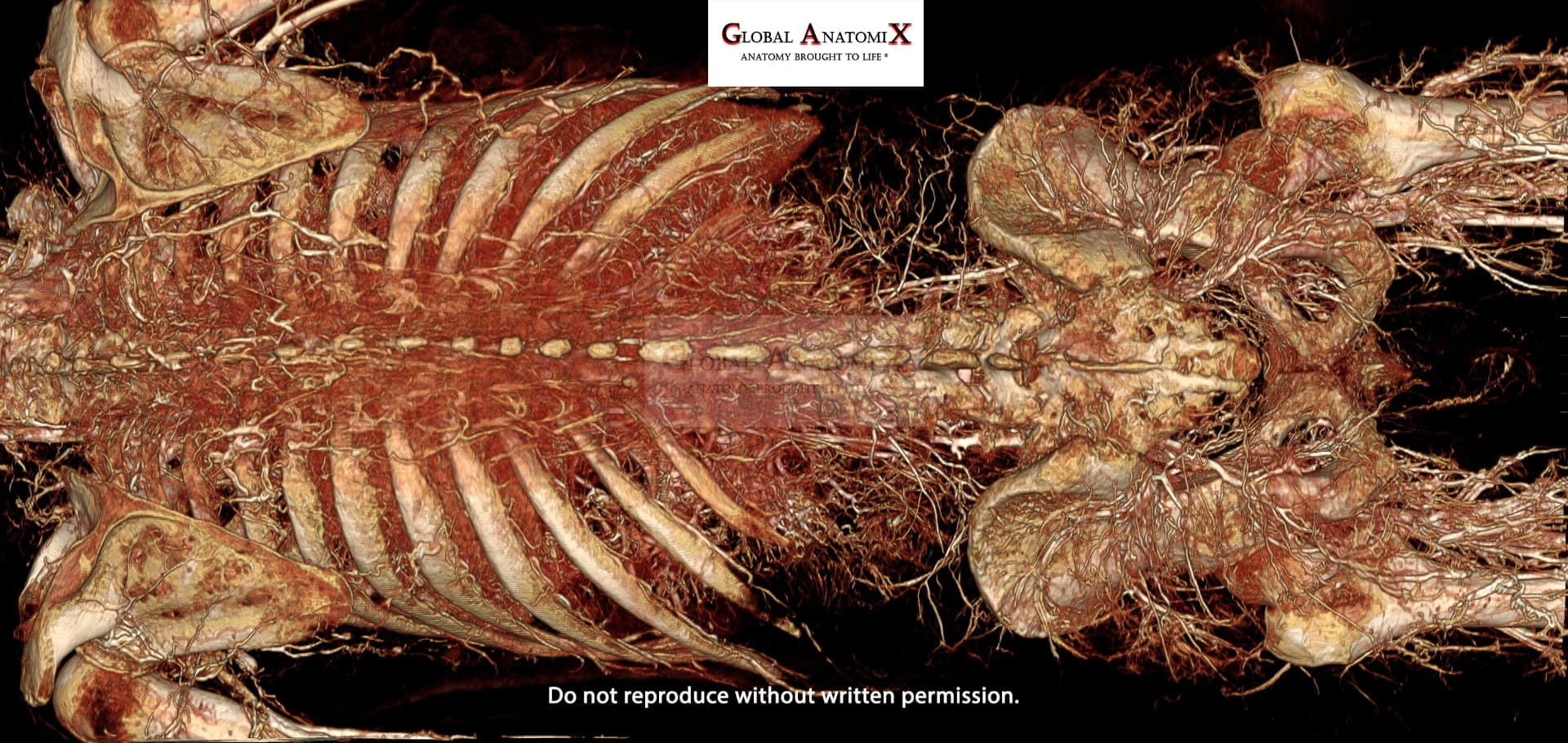 Abdomen and thorax posterior vasculature