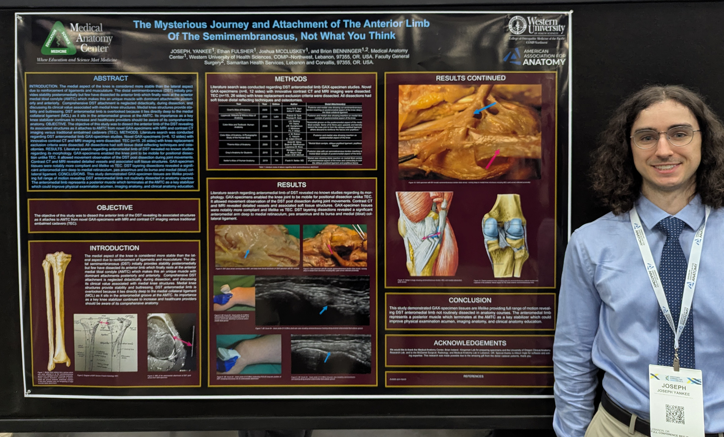 Semimembranosus muscle research poster (2025)